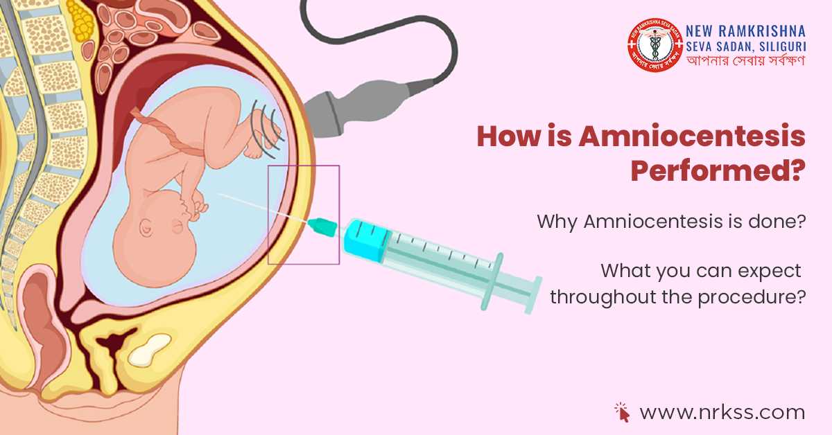 How is Amniocentesis Performed?